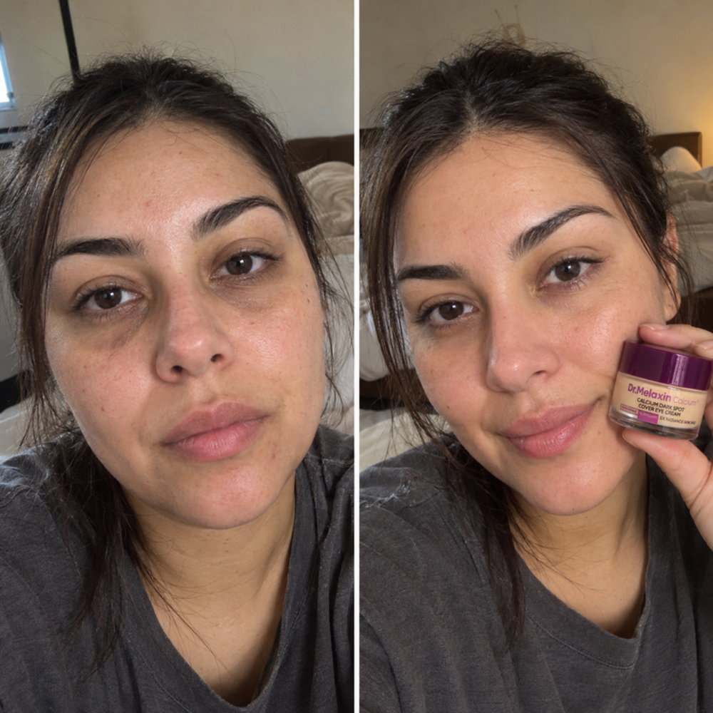 Dr.Melaxin tinted eye cream, look of the under-eye bare and after one dab