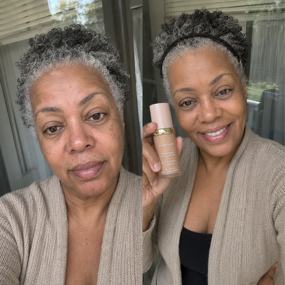 Before / after image