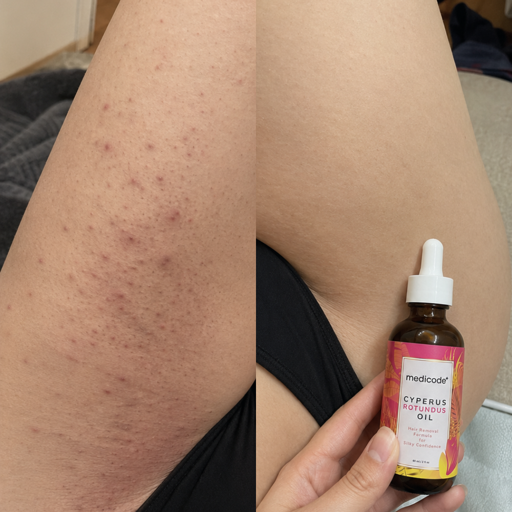 Before / after image