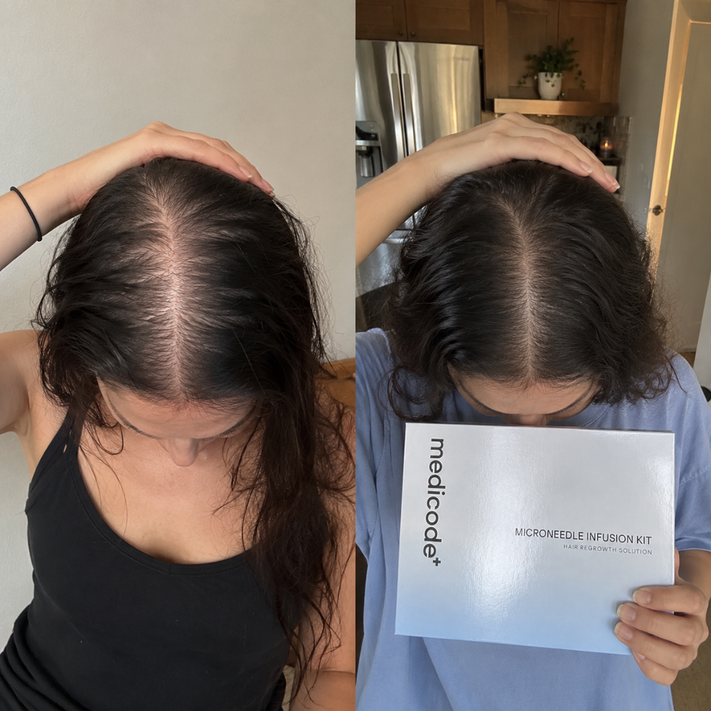 Before / after image
