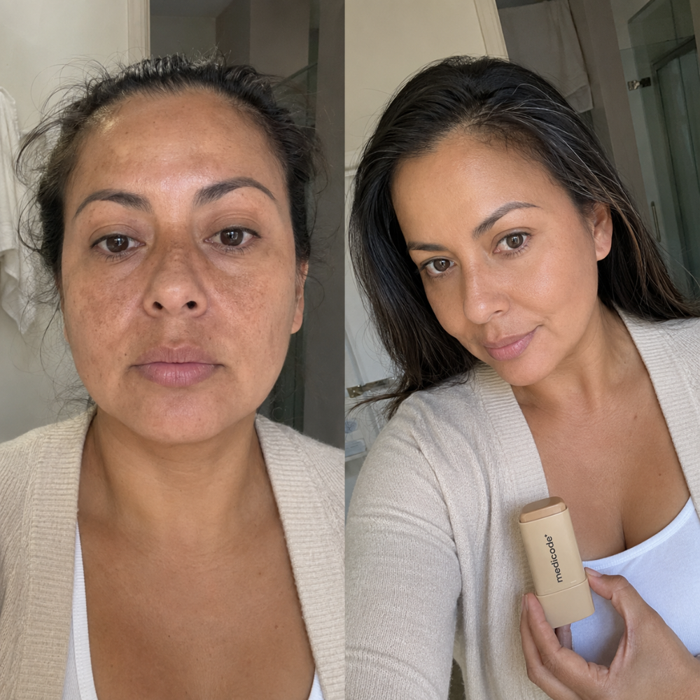 Before / after image