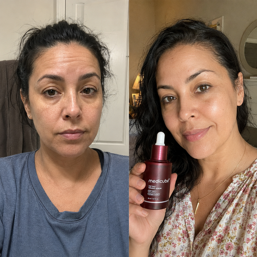 Before / after image