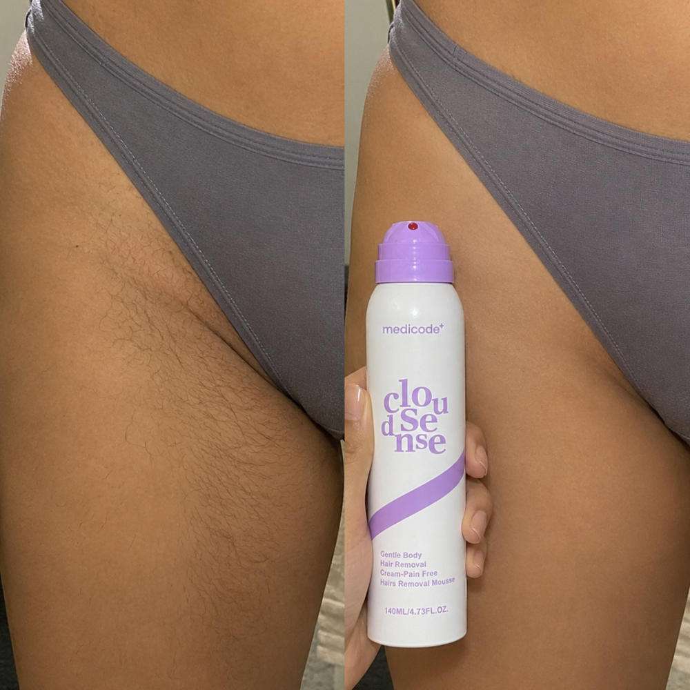 Before / after image