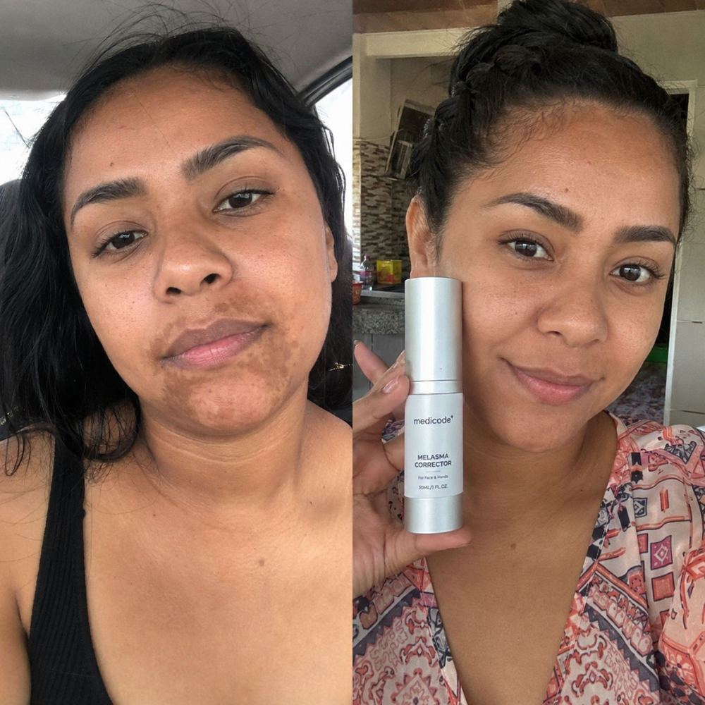 Dark spot corrector serum, before and after appearance