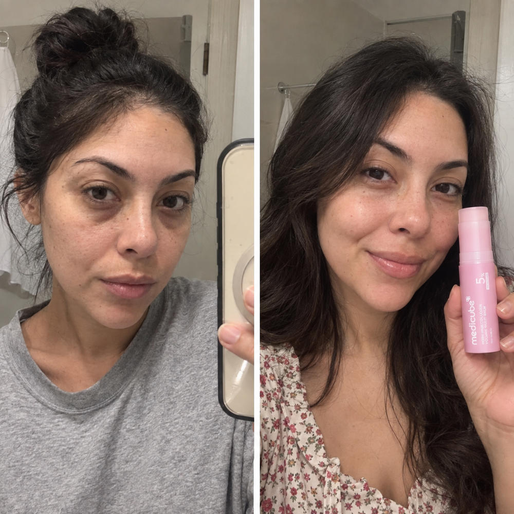 Before / after image
