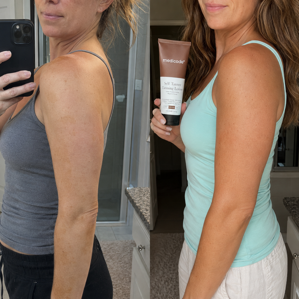 Before / after image