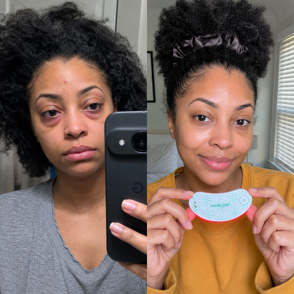 Before / after image