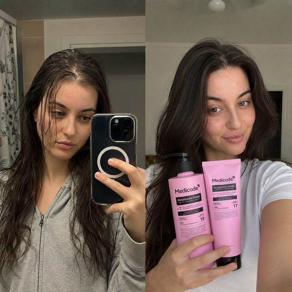 Before / after image