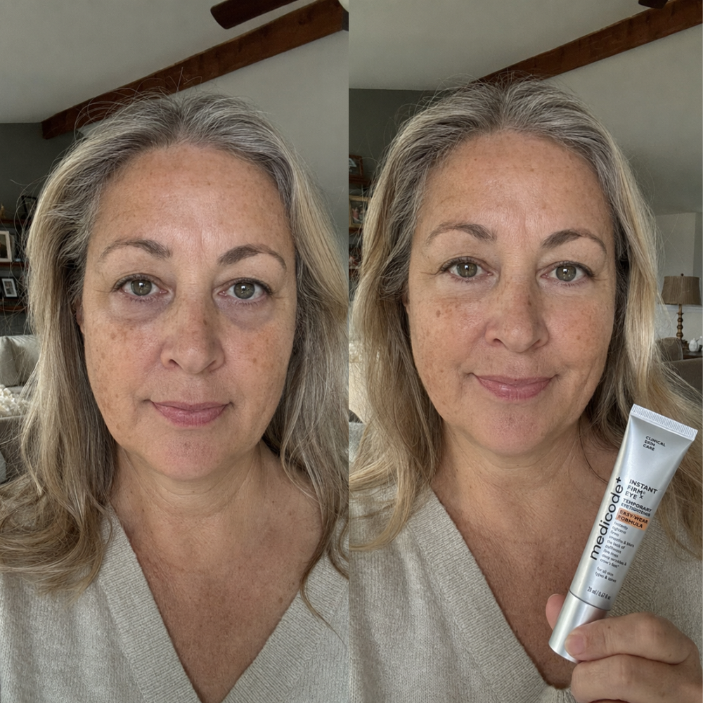 Before / after image