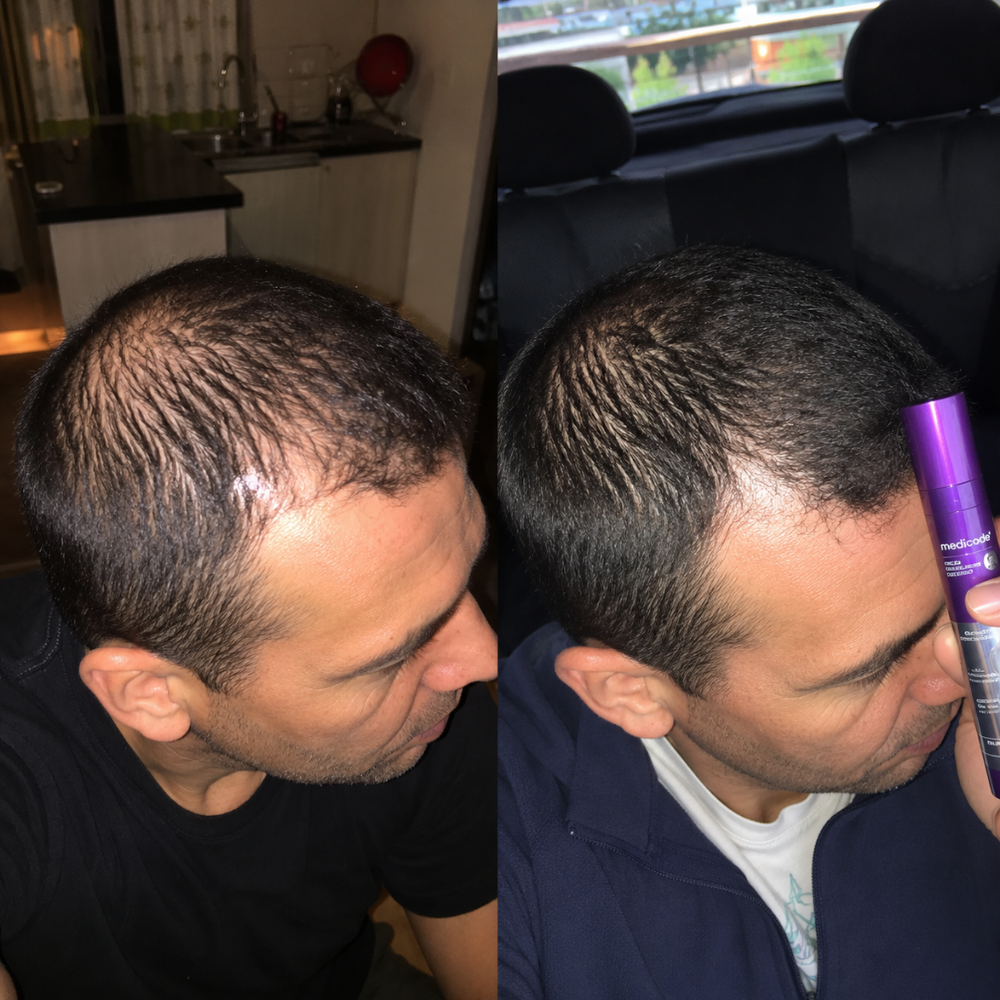 Before / after image