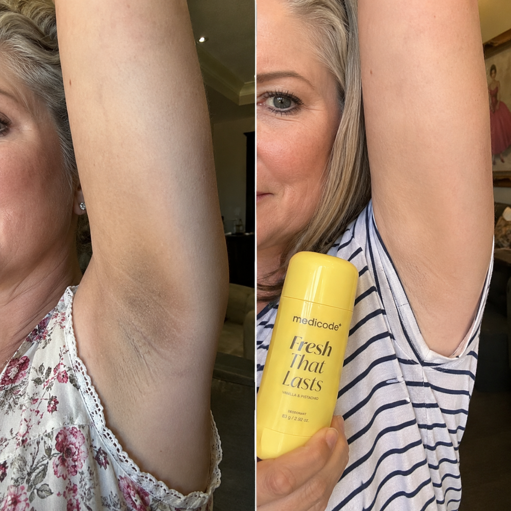 Before / after image