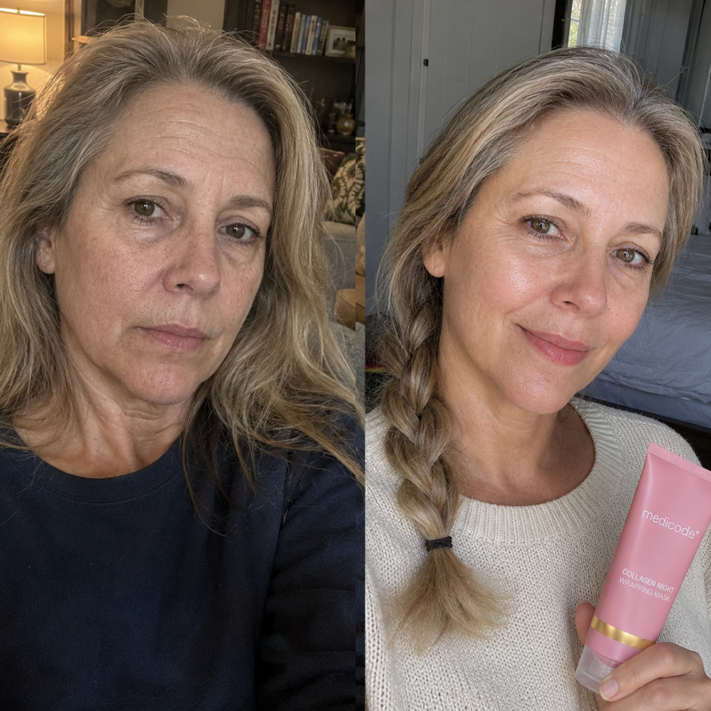 Before / after image