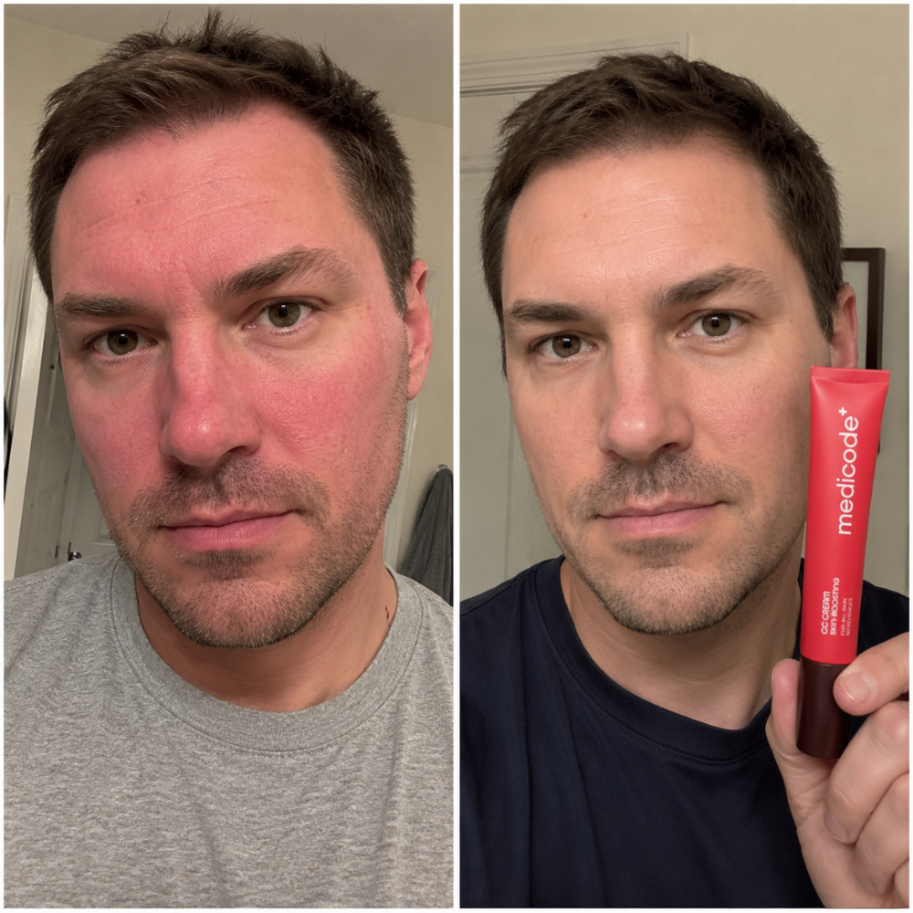 Before / after image