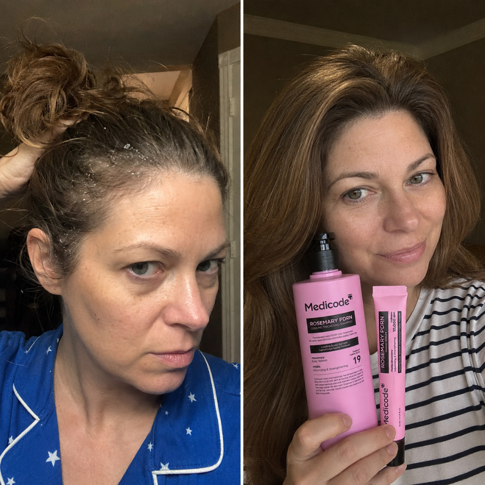 Before / after image