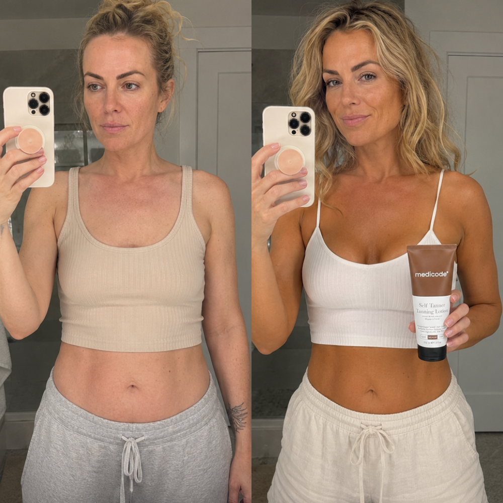 Before / after image