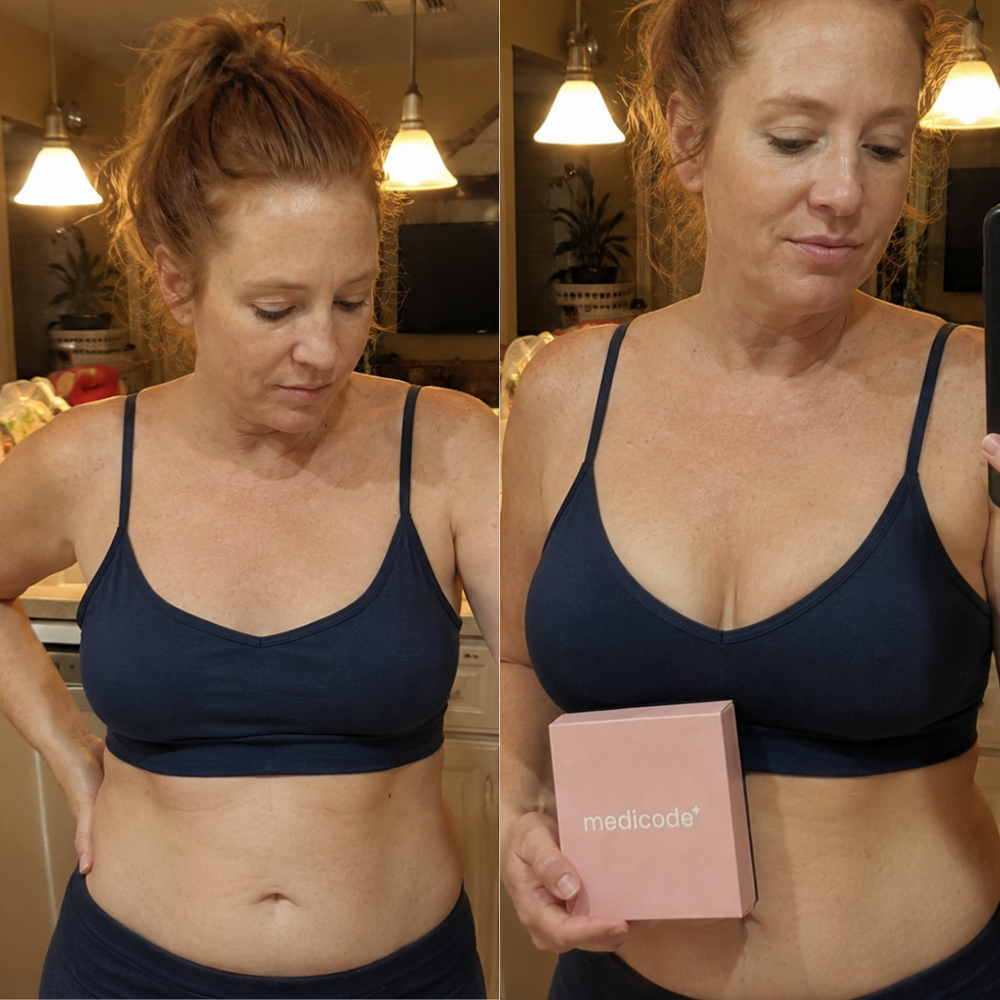 Before / after image