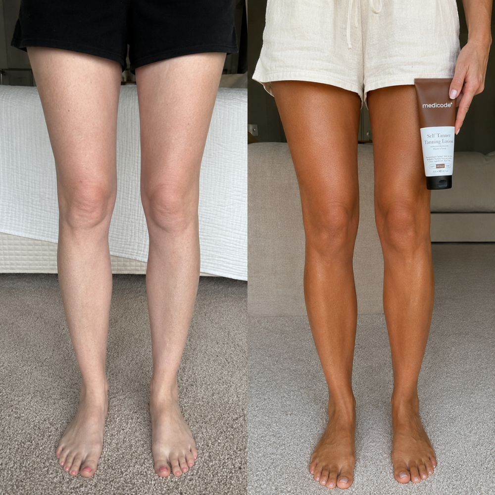 Before / after image