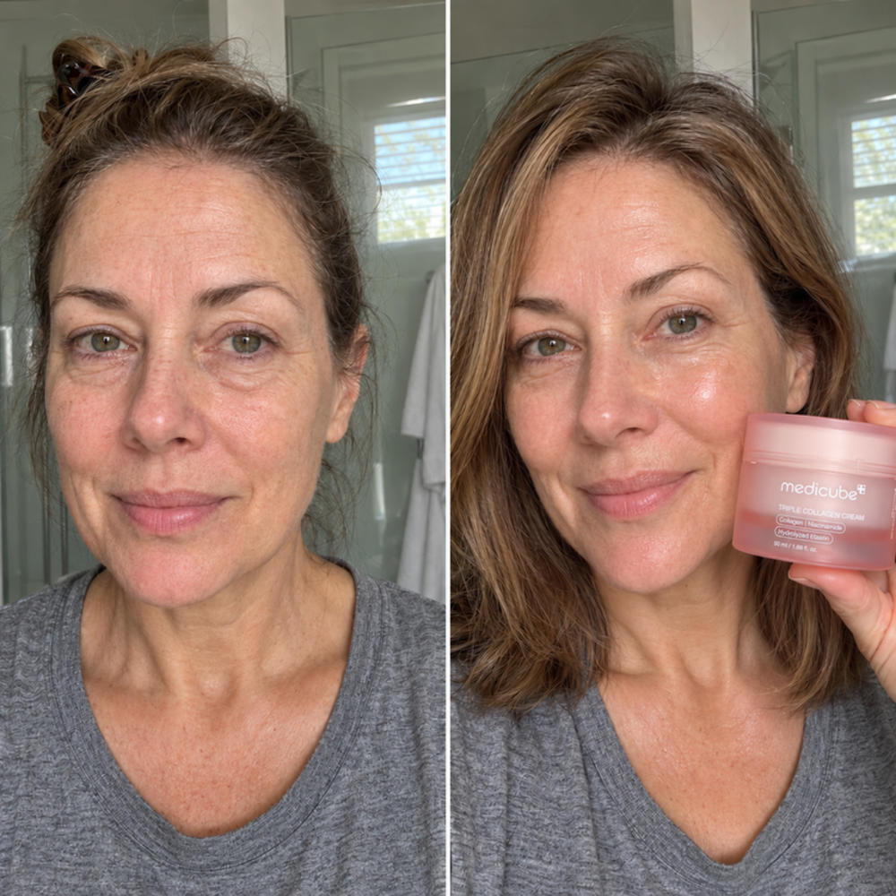 Medicube collagen set, look of bouncier skin before and after one routine