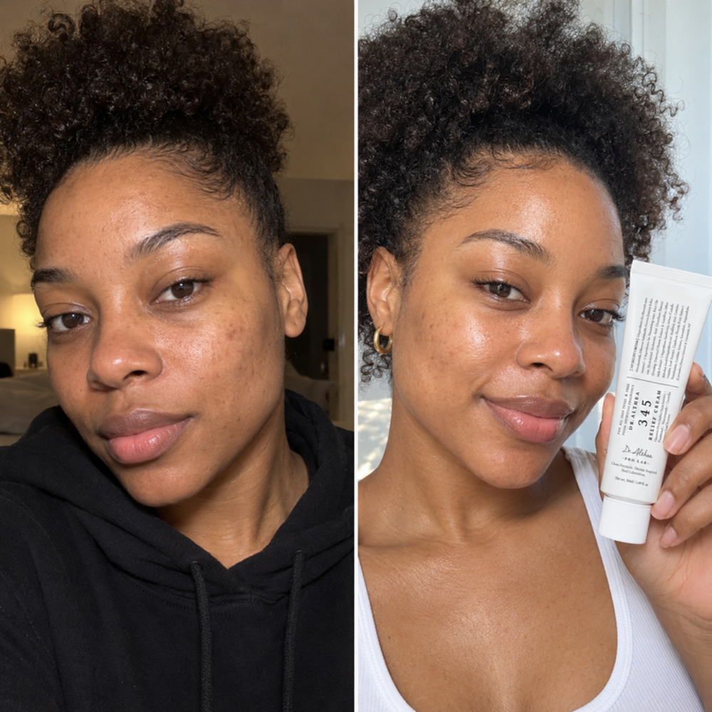 Lightweight gel cream on oily skin, look of the face before and after one use