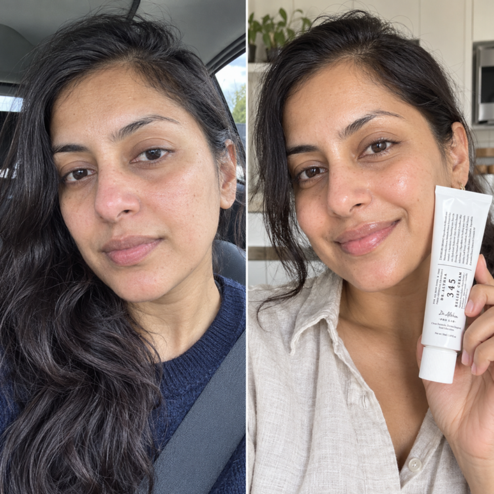 Niacinamide and ceramide gel cream, look of combination skin before and after one use