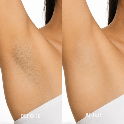Bikini Pain-Free Hair Removal Cream for Sensitive Skin