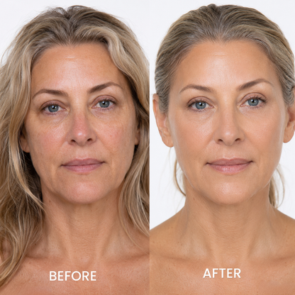 Changing Foundation 4 in 1