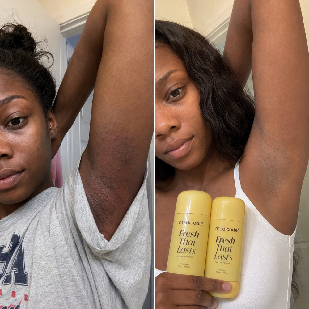 Before / after image