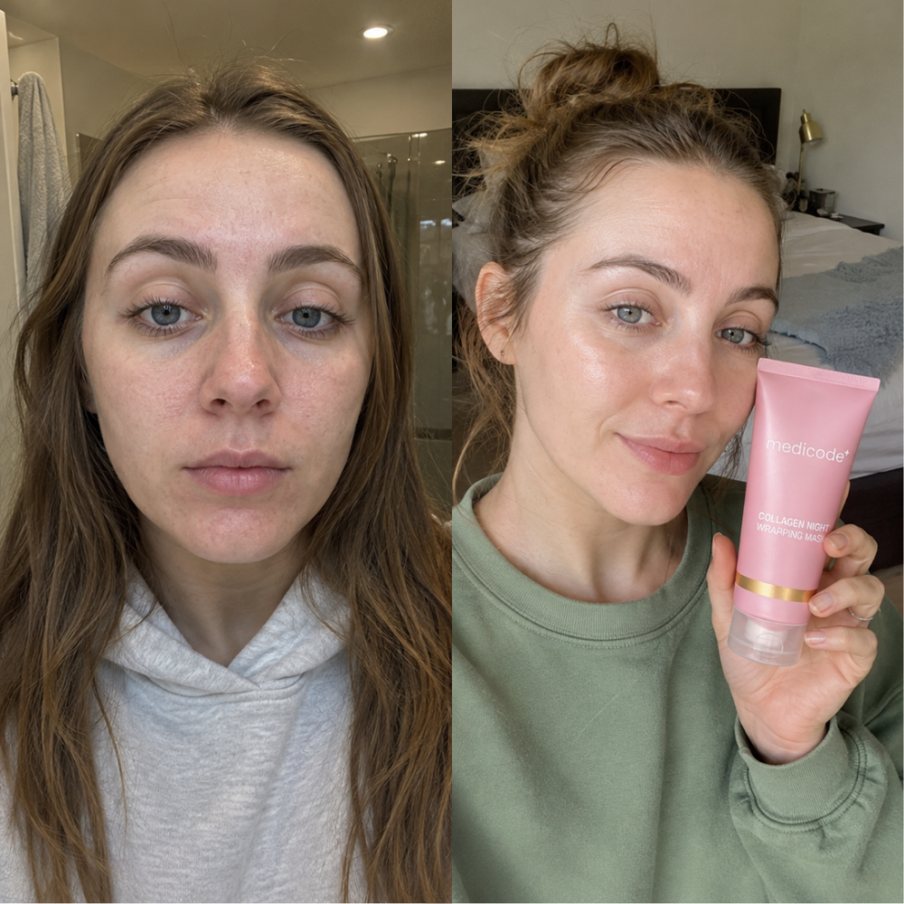 Before / after image