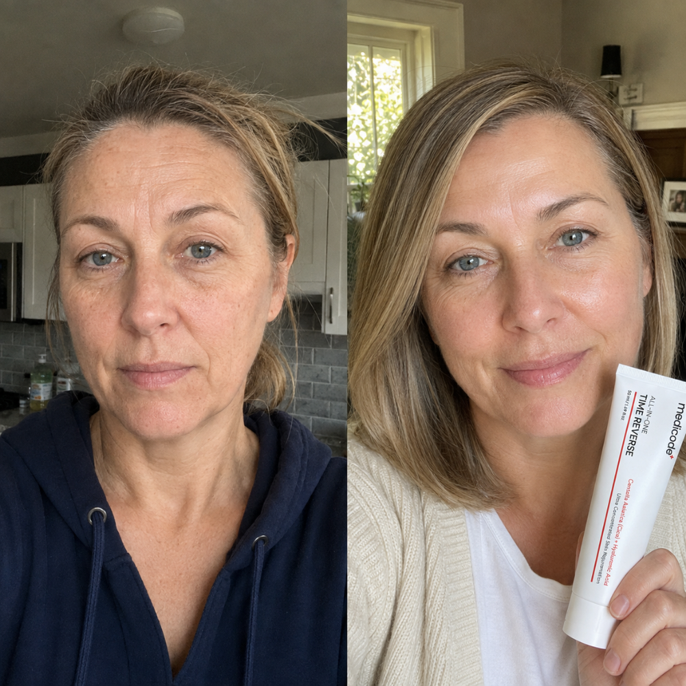 Before / after image