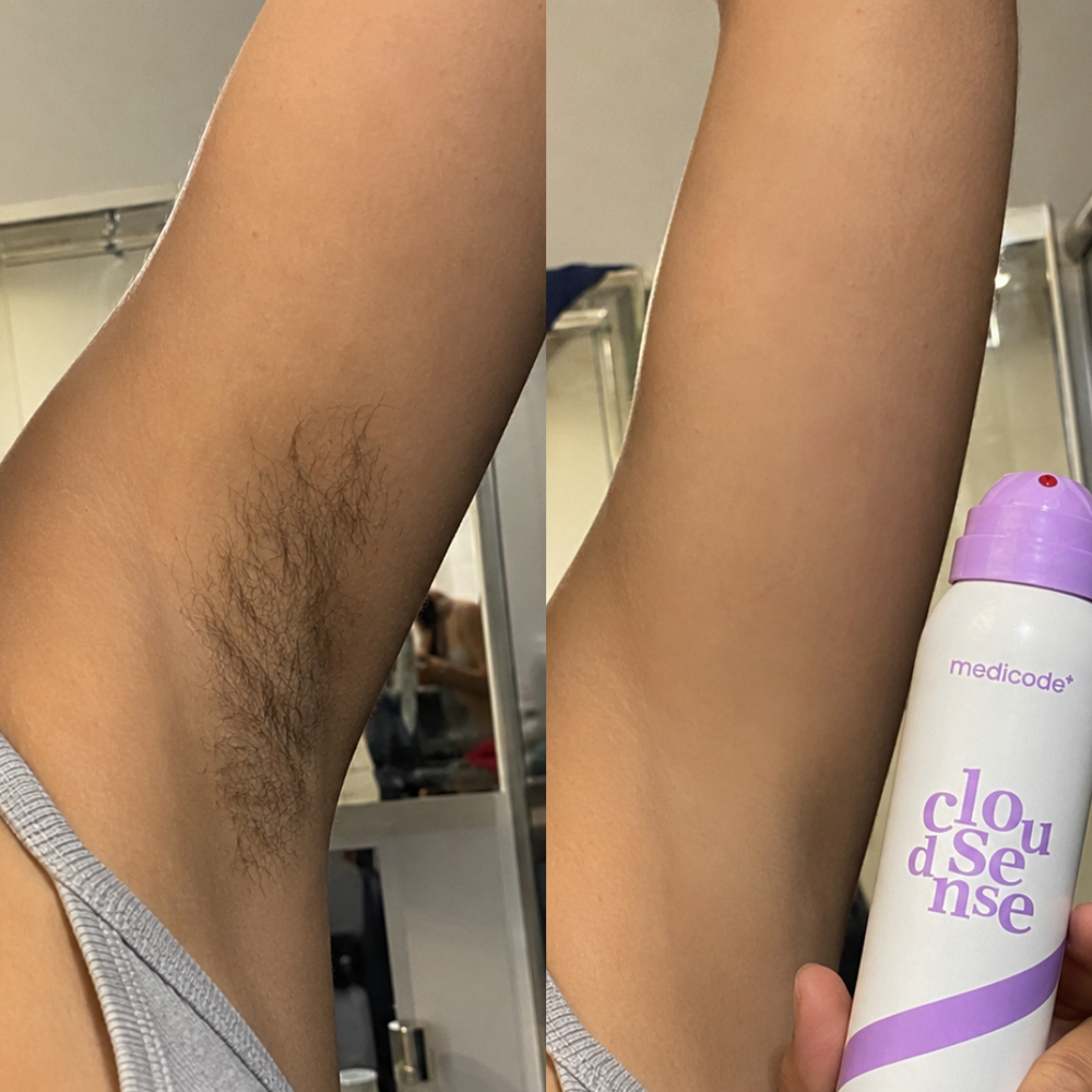 Before / after image