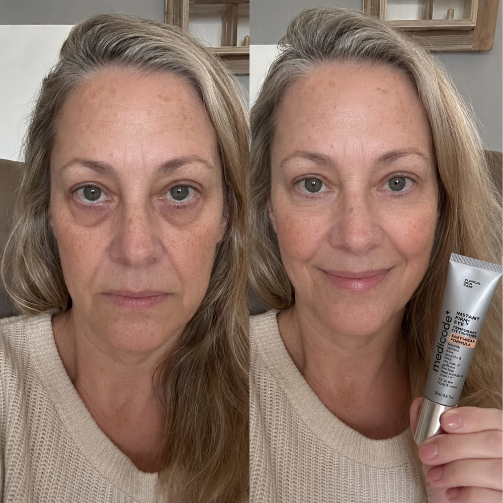 Before / after image