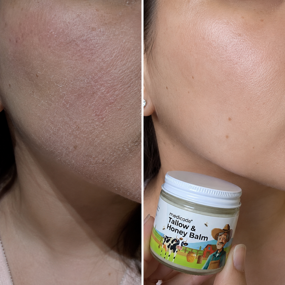 Before / after image