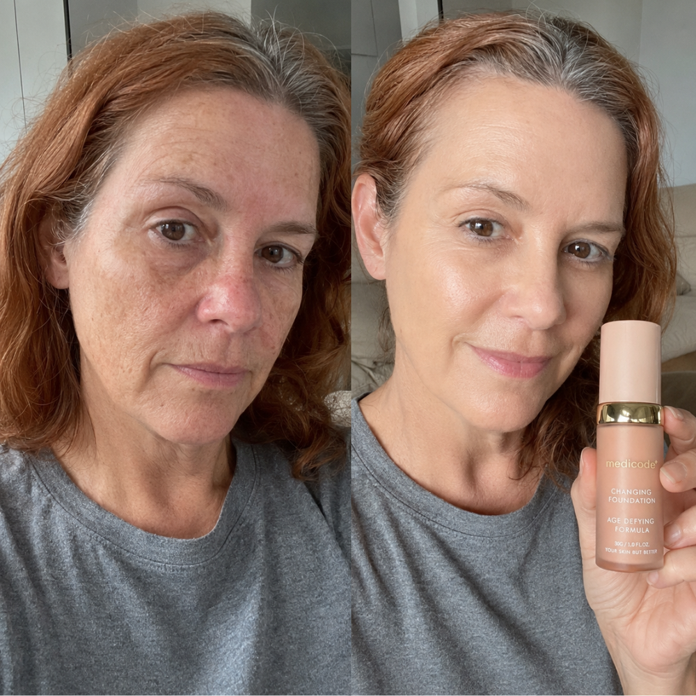 Before / after image