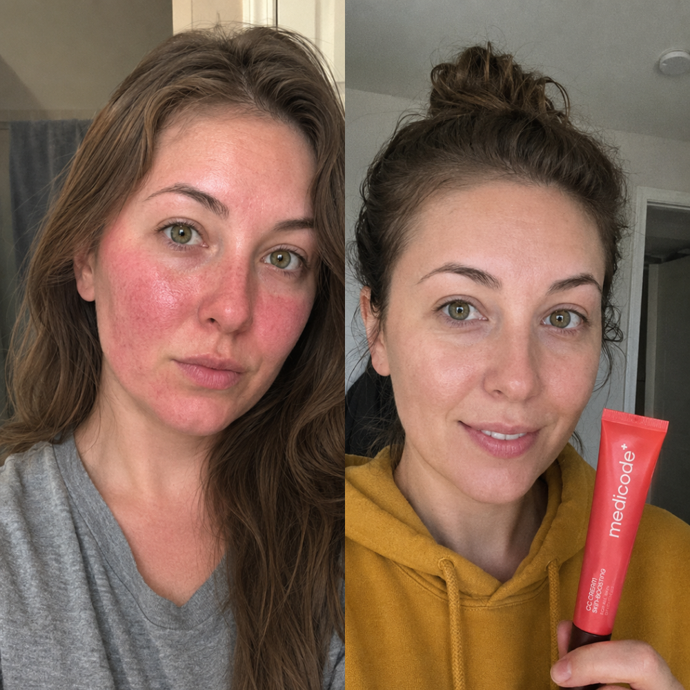 Before / after image