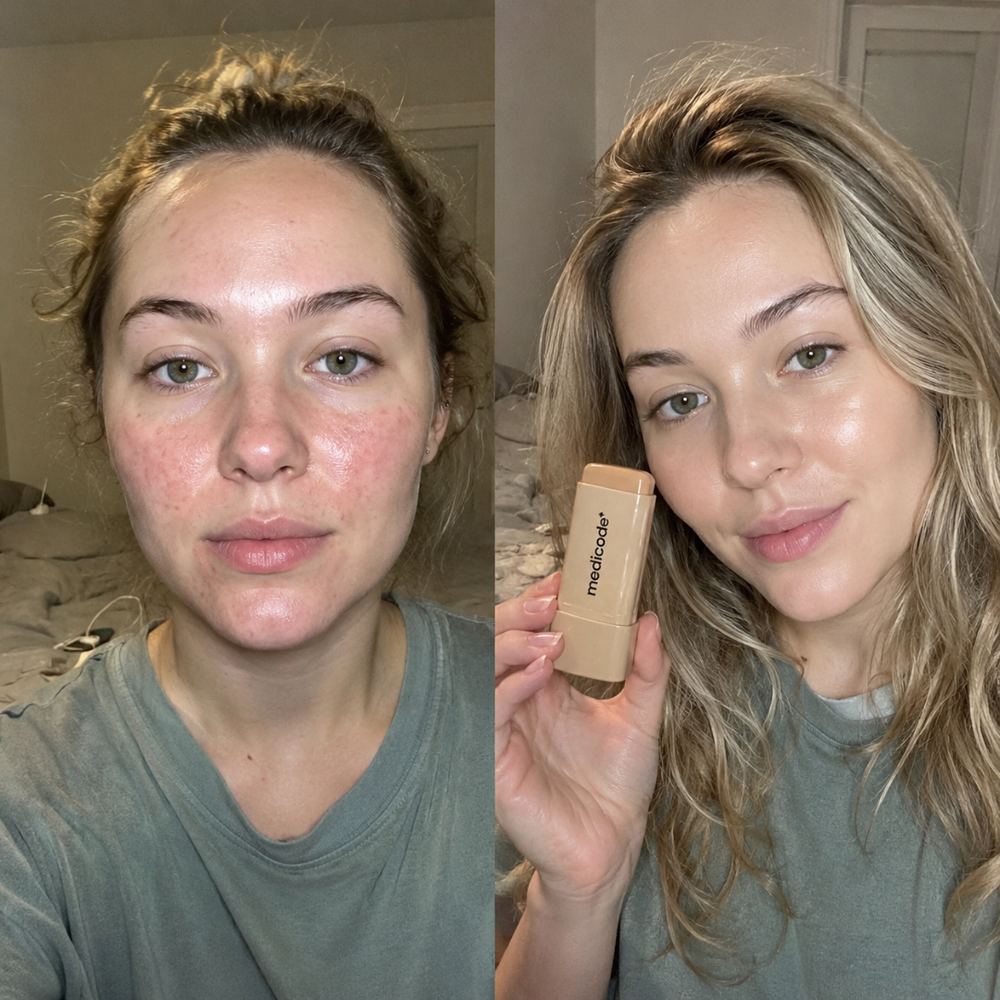 Before / after image