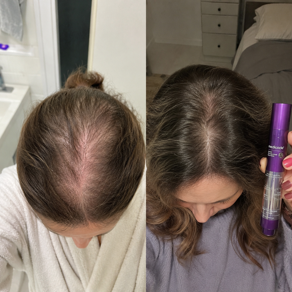 Before / after image