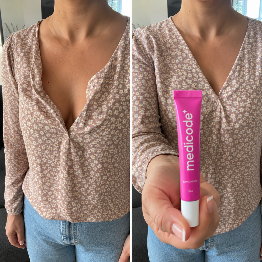 Before / after image