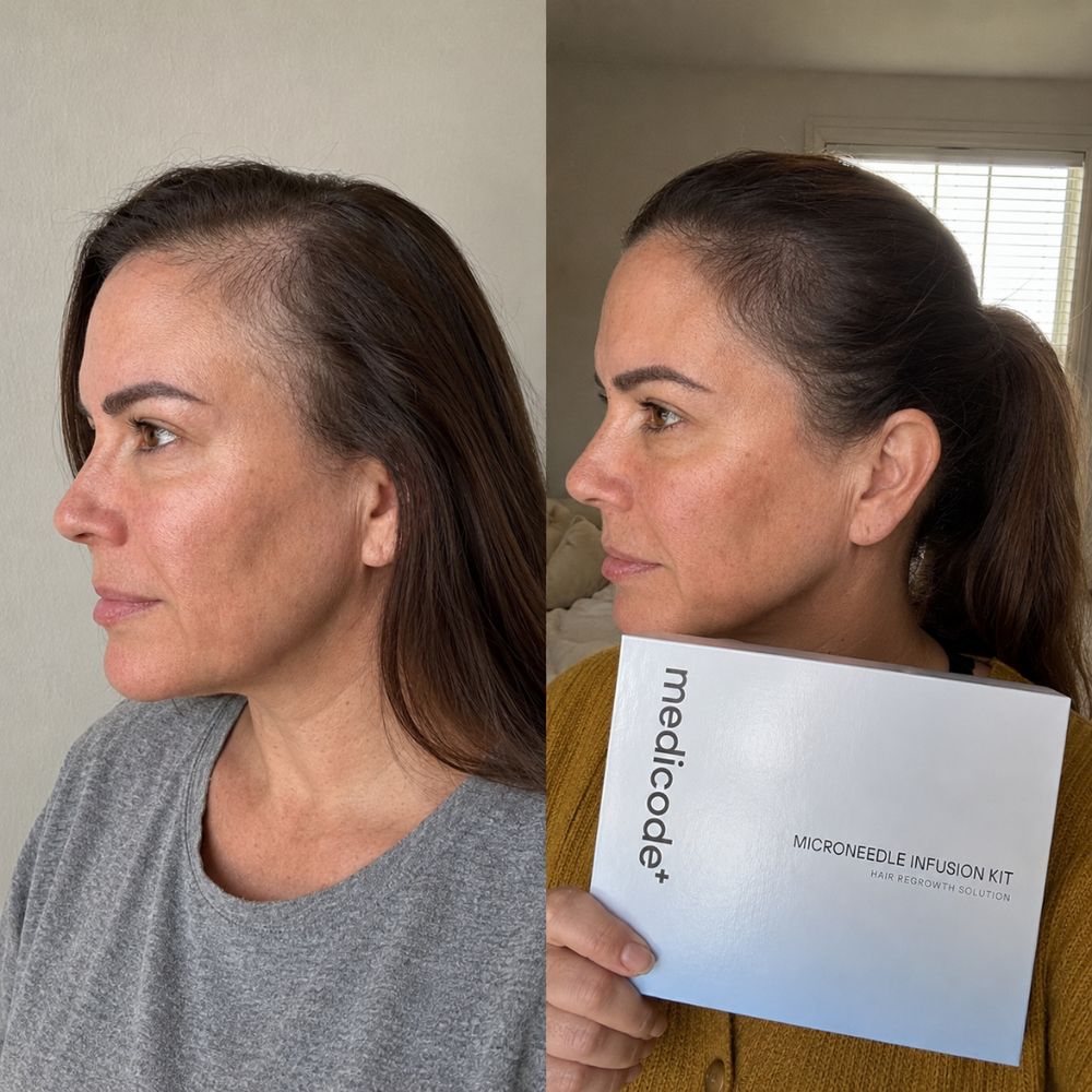 Before / after image