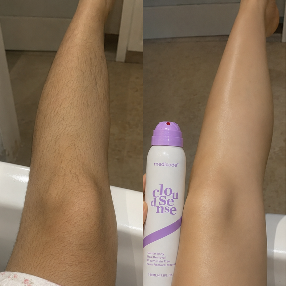 Before / after image