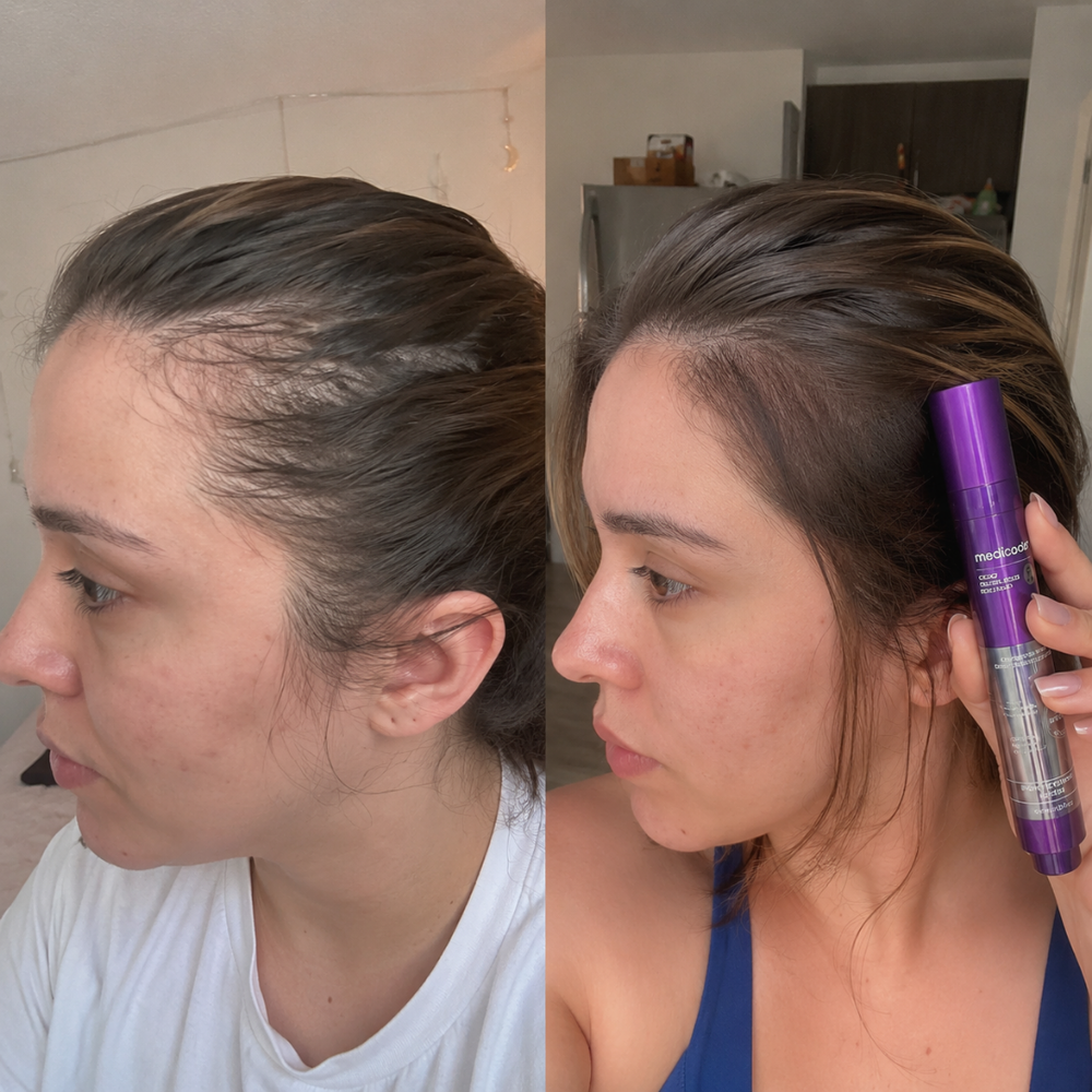 Before / after image