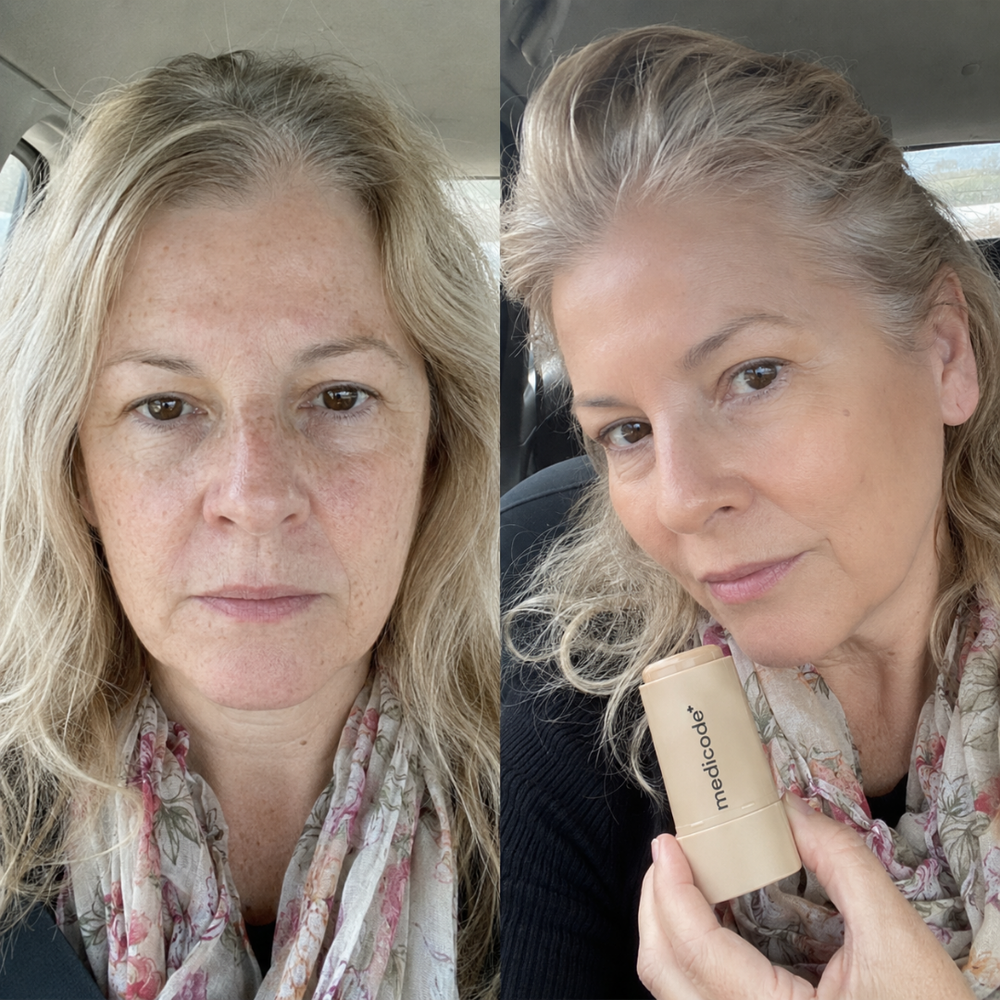 Before / after image