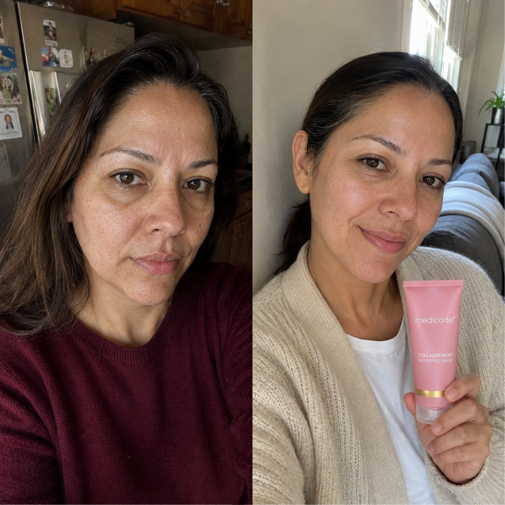 Before / after image