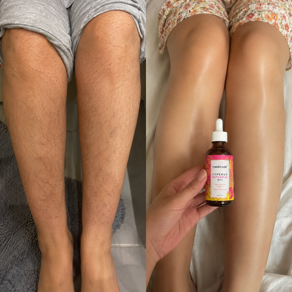 Before / after image