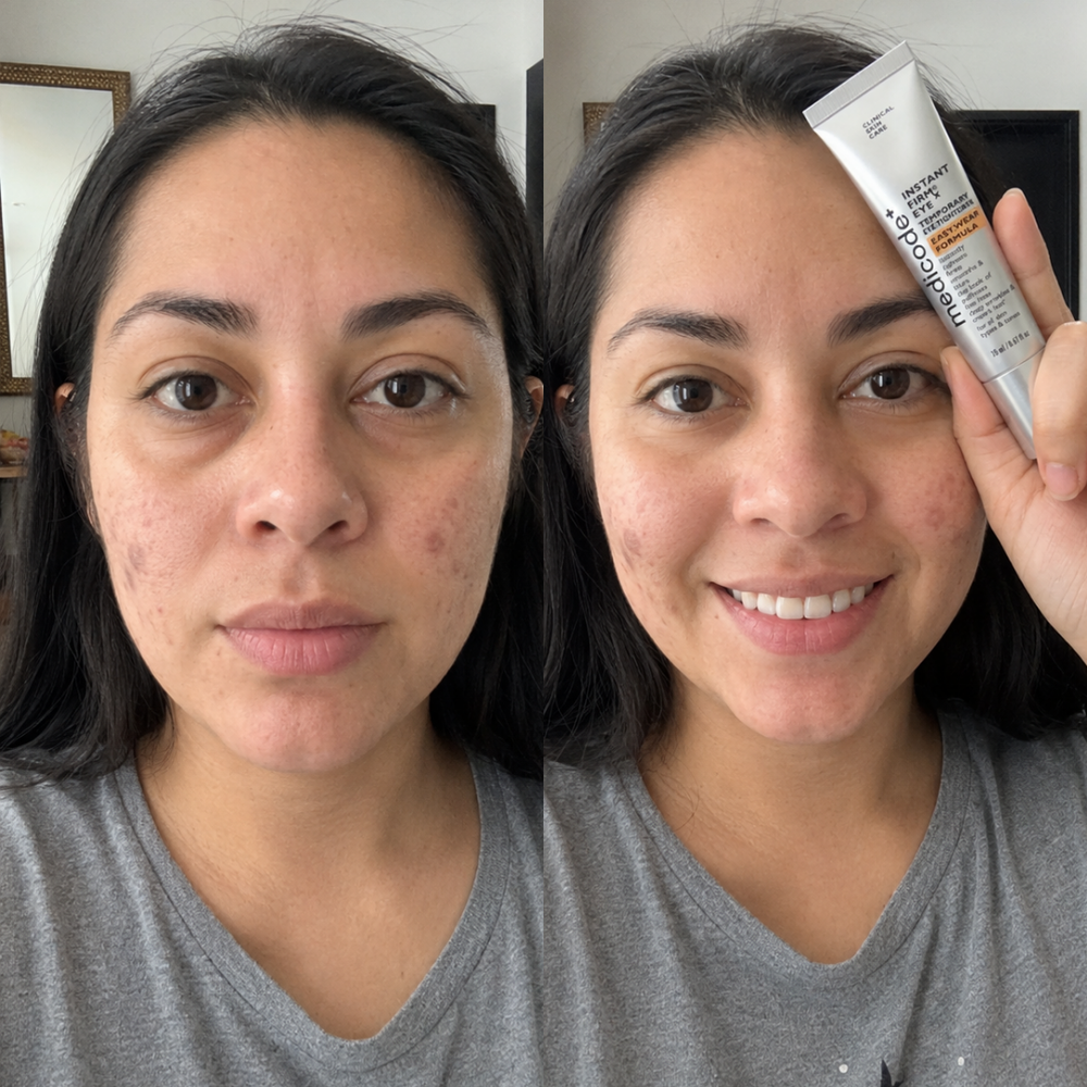 Before / after image