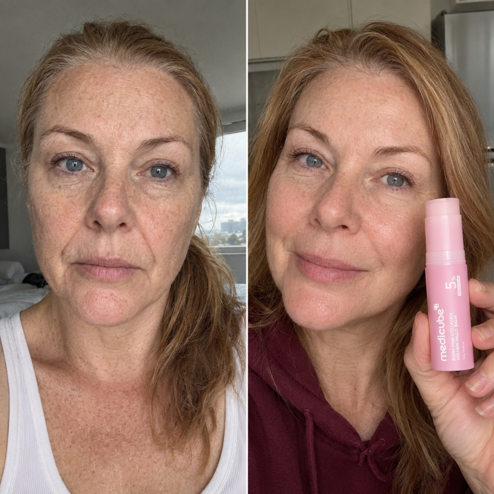 Before / after image
