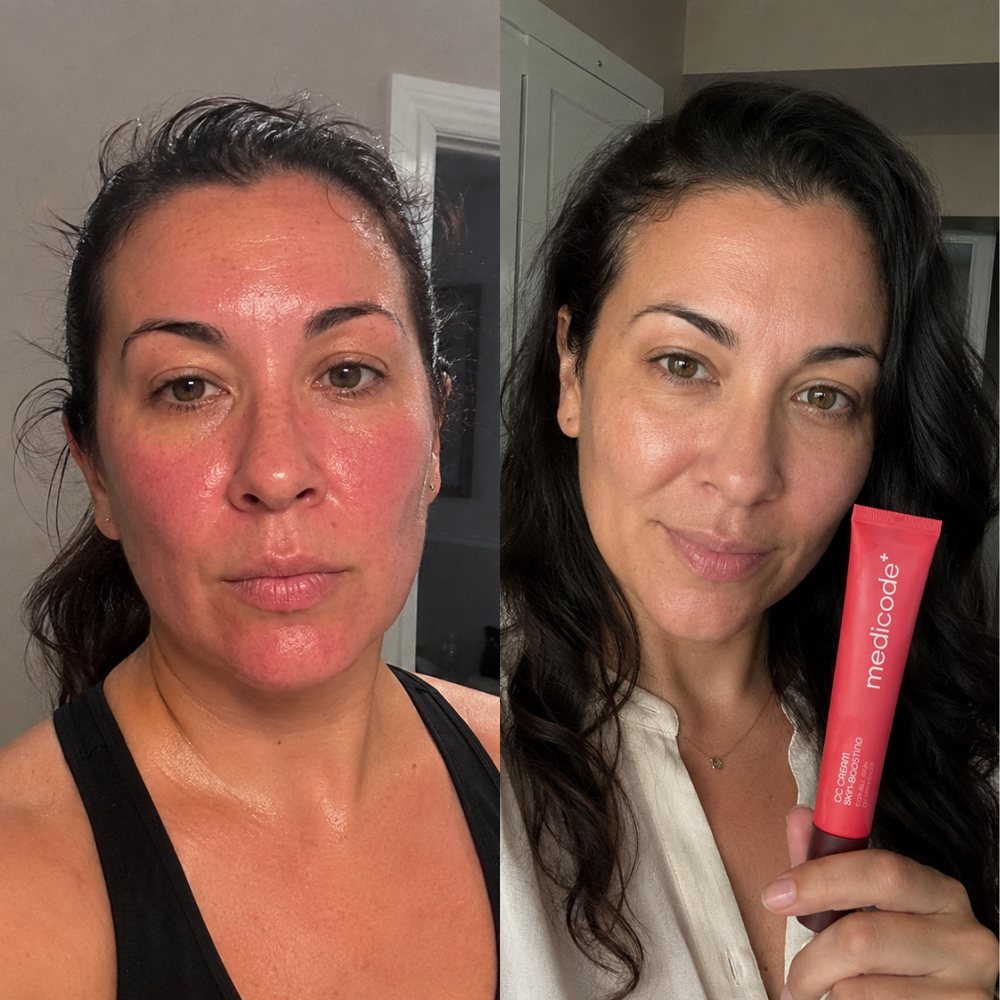 Before / after image