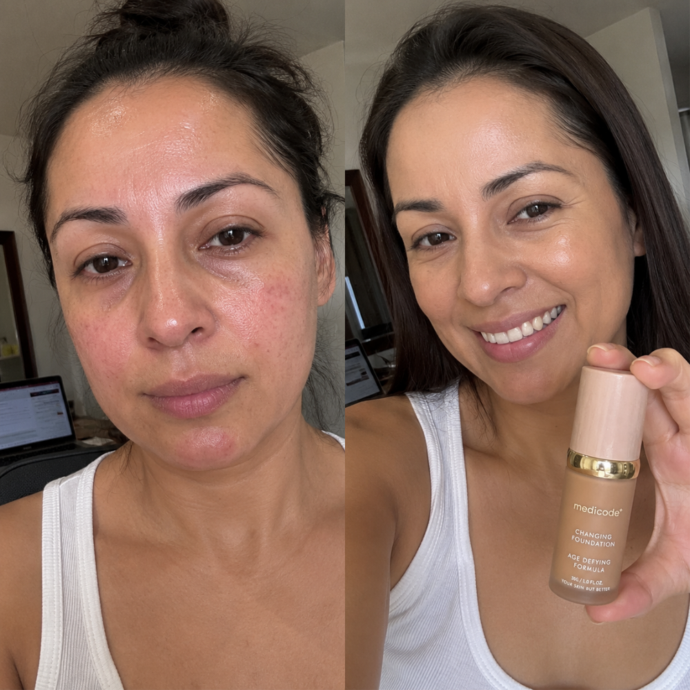 Before / after image