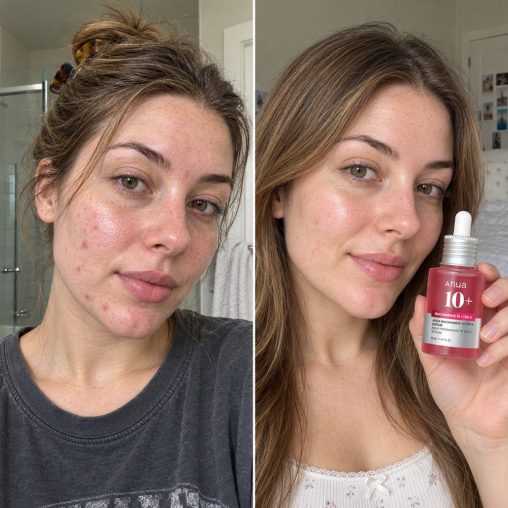 Anua Niacinamide 10+ Serum, look of skin tone bare and after daily use