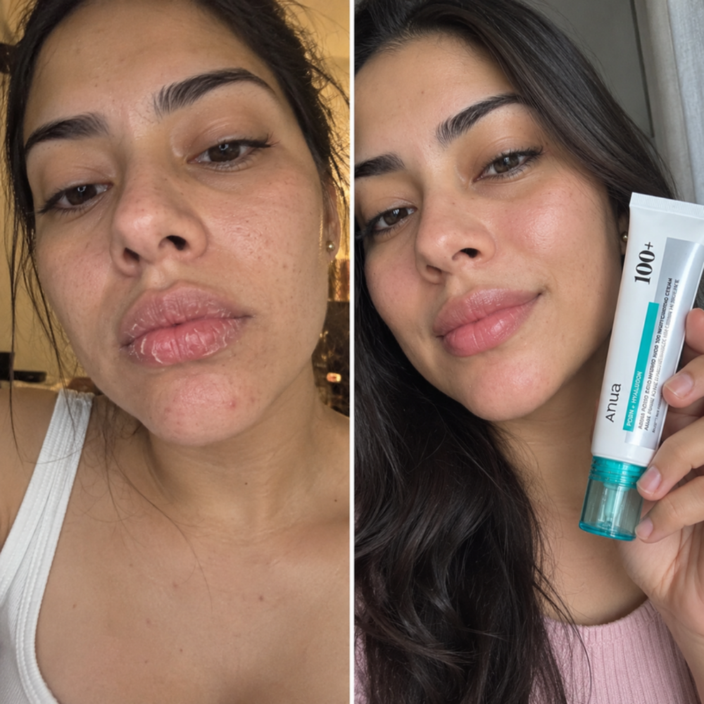 Anua PDRN moisturizing cream, bare skin next to a dewy look after one use