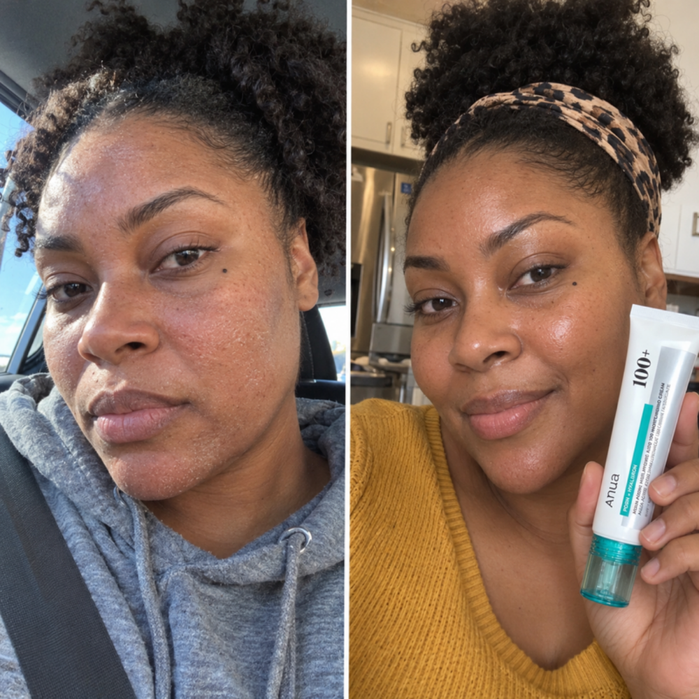 Anua PDRN moisturizing cream, bare skin next to a dewy look after one use